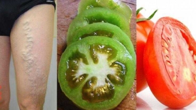 Como se livrar das varizes apenas com 2 tomates