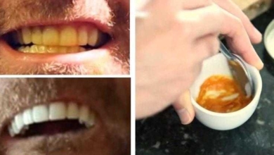 Homem clareia os dentes com um truque absurdamente simples. Veja!!