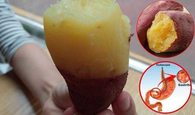 Receita caseira para acabar com azia, refluxo, gastrite e úlcera