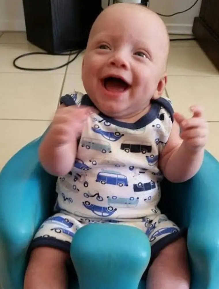 1492395856 241 o conselho do medico foi para que a mae abortasse mas ela nao o fez veja como o bebe nasceu