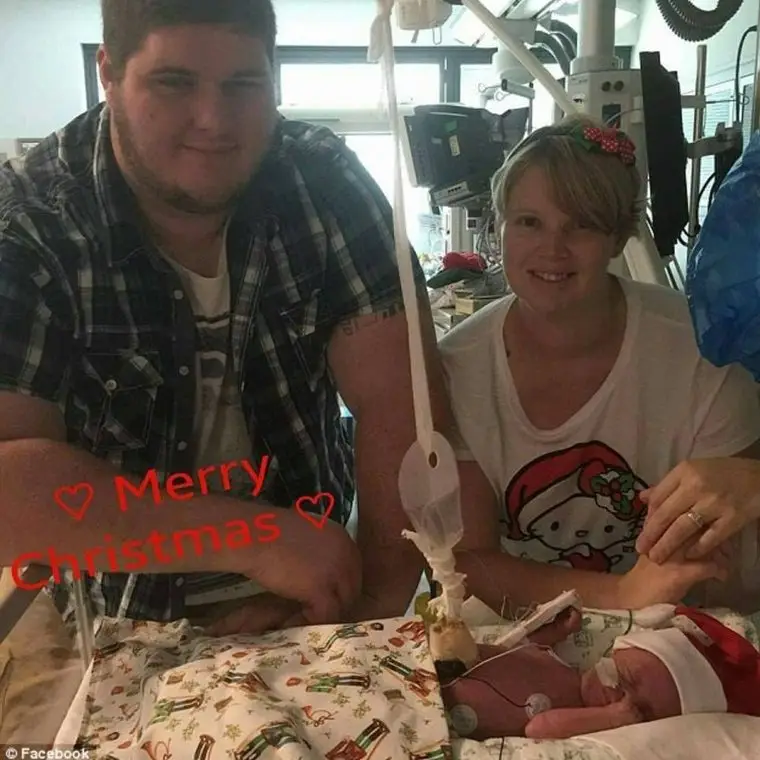 1492395856 699 o conselho do medico foi para que a mae abortasse mas ela nao o fez veja como o bebe nasceu