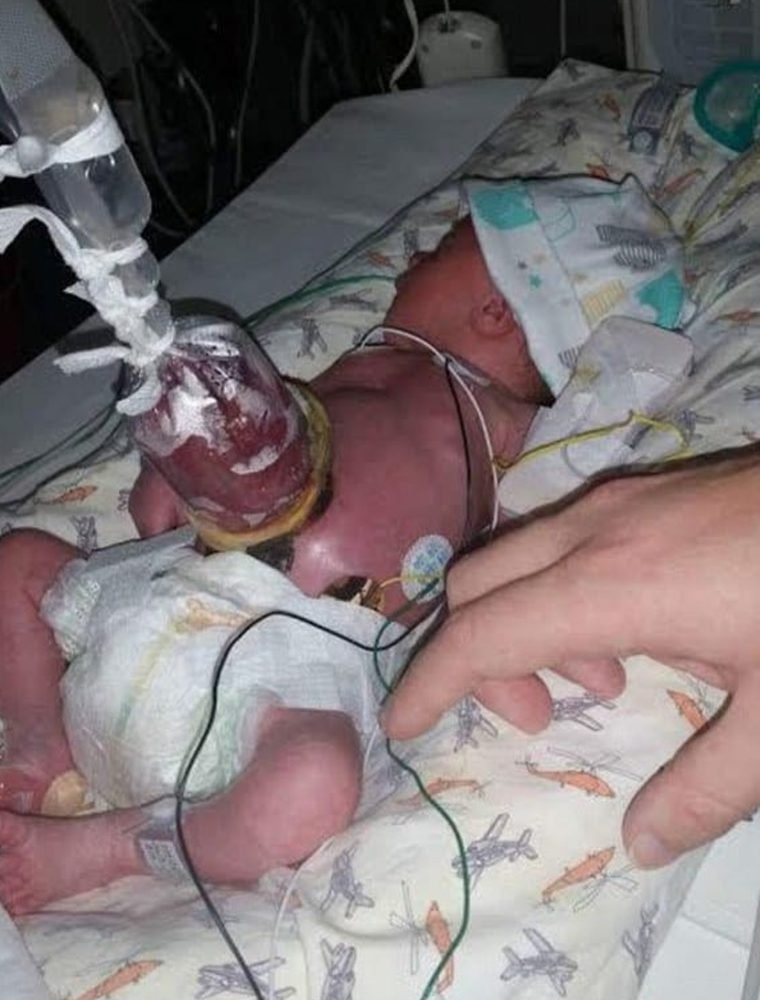 1492395856 776 o conselho do medico foi para que a mae abortasse mas ela nao o fez veja como o bebe nasceu