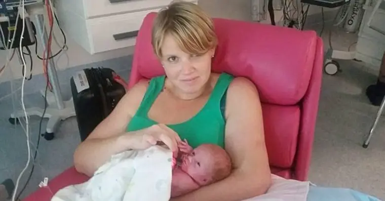 1492395856 899 o conselho do medico foi para que a mae abortasse mas ela nao o fez veja como o bebe nasceu