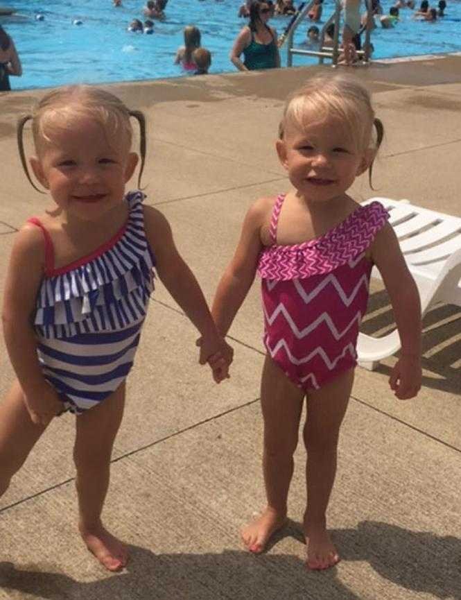 lembra das gêmeas que nasceram de mãos dadas ha 2 anos 4