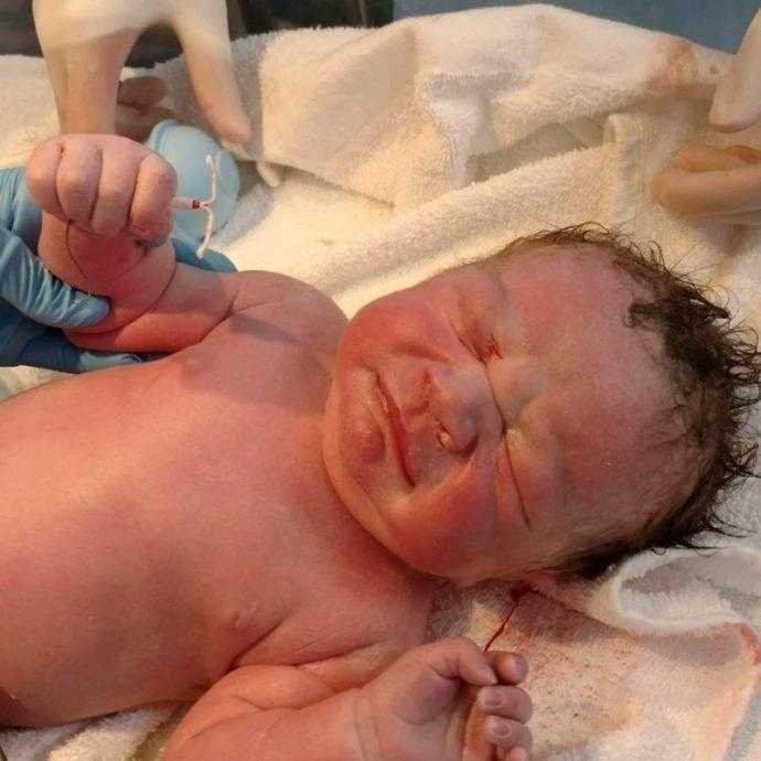 Bebê segurando DIU é sucesso na net, mãe engravidou usando método f4