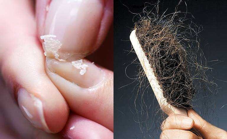 Cabelo caindo