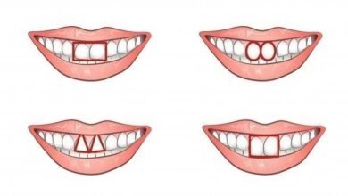 O formato dos dentes da frente revela muito sobre a sua personalidade