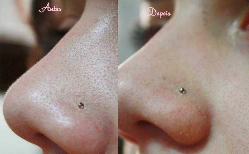 Como remover cravos do nariz usando água, sal e limão 4