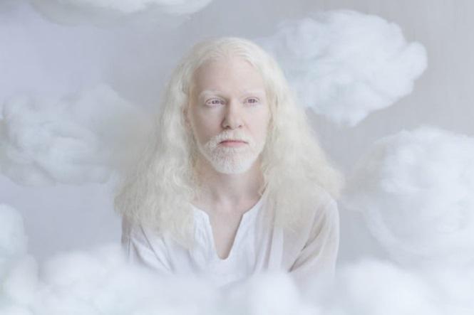12 fotos que mostram a beleza cativante de pessoas albinas