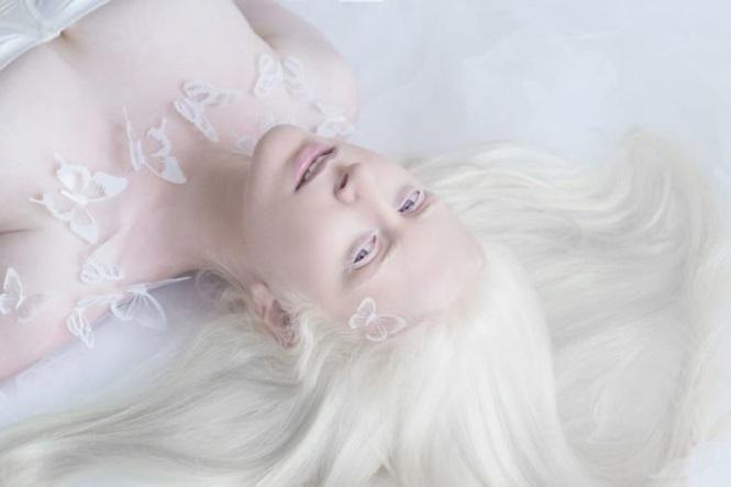 12 fotos que mostram a beleza cativante de pessoas albinas
