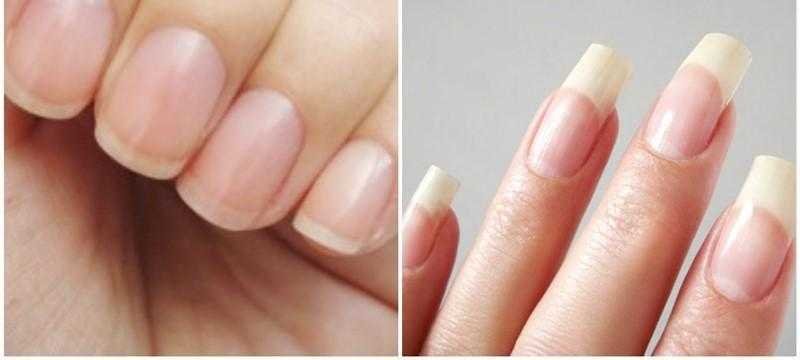 Como fazer a unha crescer mais rápido com receitas caseiras 1a