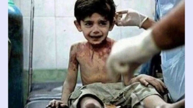 “Quando eu morrer vou contar tudo a Deus”, Afirma criança vitima da guerra na Síria