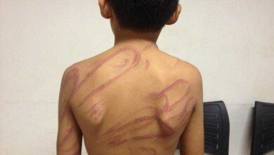 Mãe é presa após surra filho  de 7 anos com chibatadas de cipó