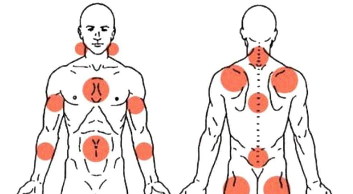 Veja como os danos nos nervos se desempenham na fibromialgia