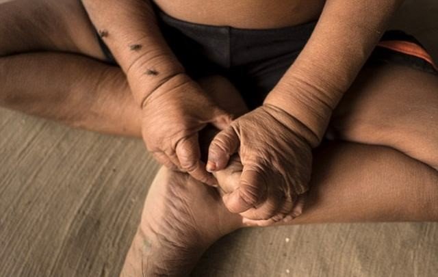 1593120323 414 Menino de 4 anos com aparencia de idoso abandona escola