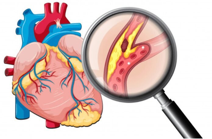 10 Coisas Que Você Precisa Saber Sobre Colesterol 10 Coisas Que Você Precisa Saber Sobre Colesterol
