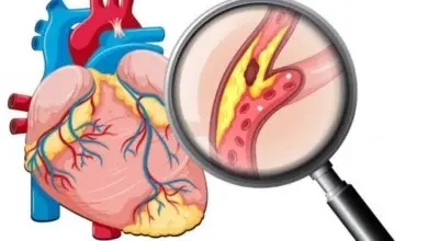 1647448691 10 Coisas Que Voce Precisa Saber Sobre Colesterol