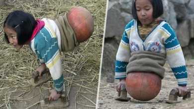 se você acha que sua vida é ruim, veja esta história inspiradora sobre a garota “basquete”