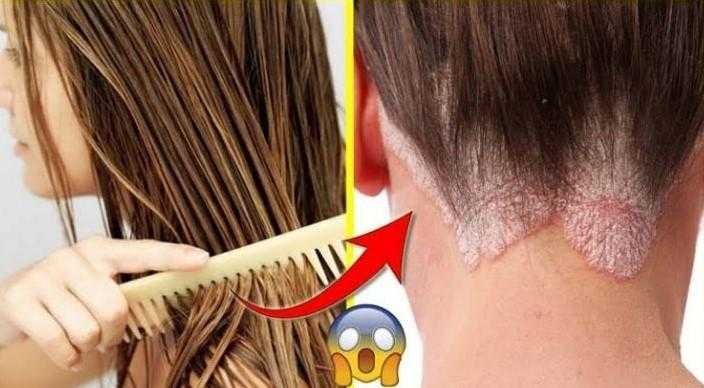 5 razões para não dormir com cabelo molhado