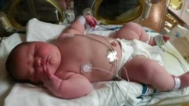 bebê nasce com mais de 6kg e impressiona médicos