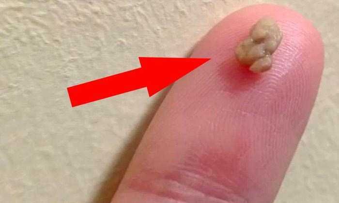 1 em cada 4 pessoas sofrem deste problema que causa 1 em cada 4 pessoas sofrem deste problema que causa mau hálito! Aprenda a corrigi-lo