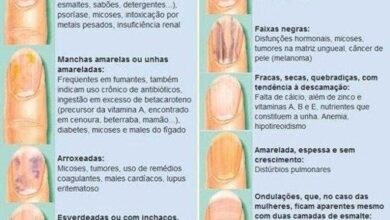 10 Sinais nas unhas que podem indicar problemas graves de 10 Sinais nas unhas que podem indicar problemas graves de saúde