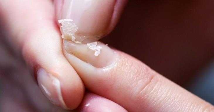 10 coisas erradas que voce faz e deixa suas unhas 10 coisas erradas que você faz e deixa suas unhas fracas e quebradiças