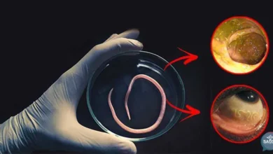 10 Sinais de que seu corpo está com ameba e outros parasitas