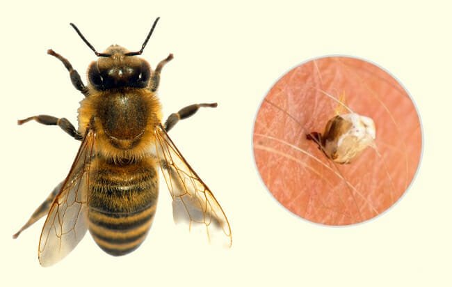 10 tipos de picadas de insetos que voce deve reconhecer