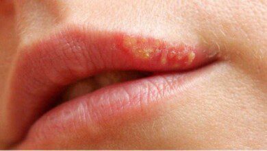 11 Sinais que revelam que sua pele está sofrendo os efeitos do estresse