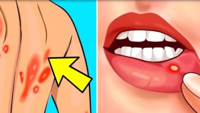 11 sintomas de HIV que nenhuma mulher pode em hipotese 11 sintomas de HIV que nenhuma mulher pode em hipótese alguma ignorar.