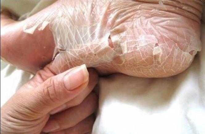 12 imagens que e dificil olhar sem se incomodar