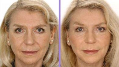 3 mascaras caseiras anti rugas