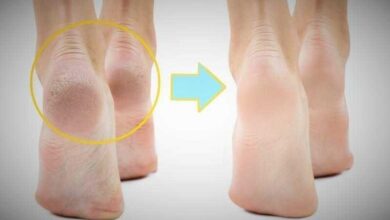 Pé rachado? Solução MAIS barata do mundo!