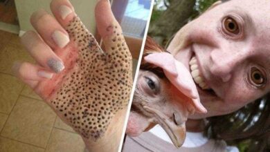 12 imagens que é difícil olhar sem se incomodar