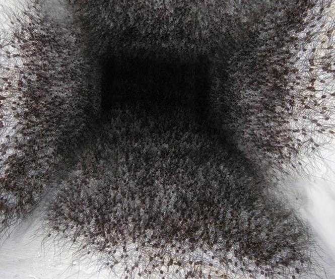 1749176638 295 12 imagens que e dificil olhar sem se incomodar