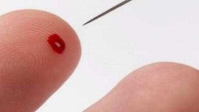 Veja como salvar uma pessoa de um AVC usando apenas uma agulha! gt