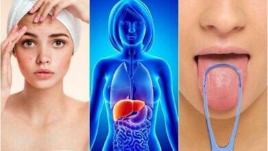 7 Sinais do corpo de um fígado sobrecarregado 1