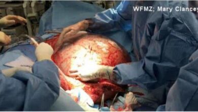 Ela Não Conseguia Perder Peso. Quando Foi Ao Médico Descobriu Algo Horrível!