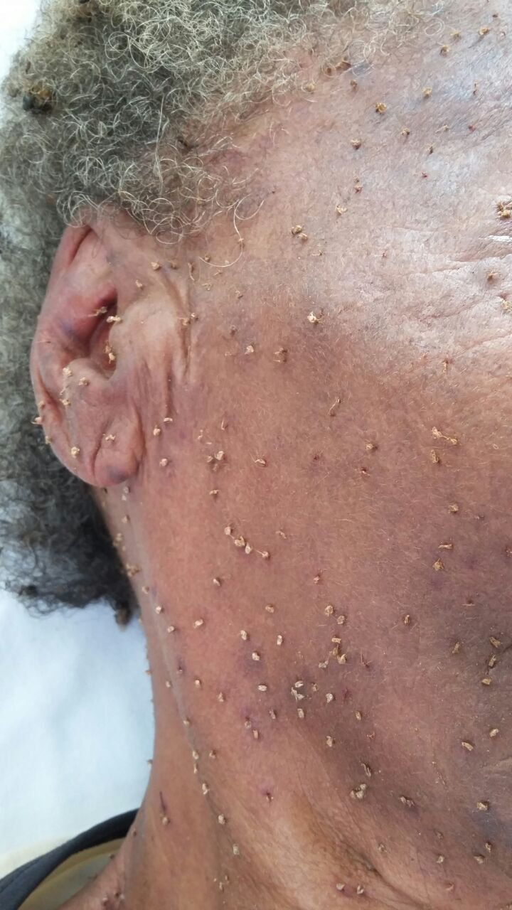 1749222788 199 Senhora morre apos ser picada por cerca de 500 abelhas