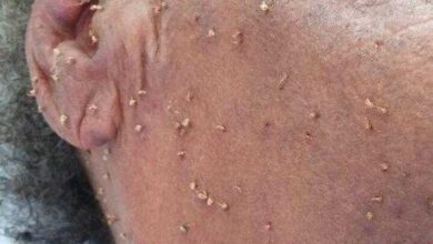 Senhora morre após ser picada por cerca de 500 abelhas