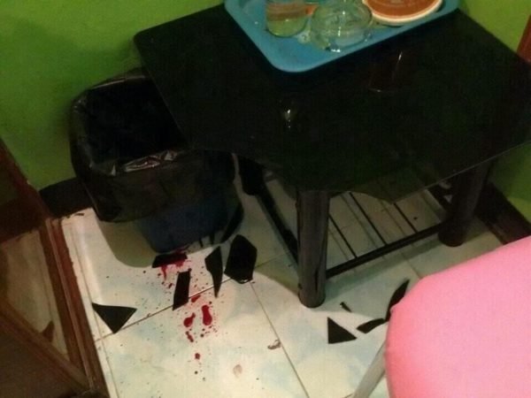 1749225310 222 Noite de amor termina em hospital apos tentativa de posicao