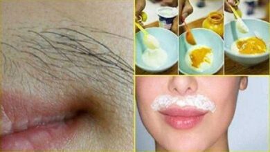 Acabe de vez com os pelos do buço e do rosto com esta receita caseira