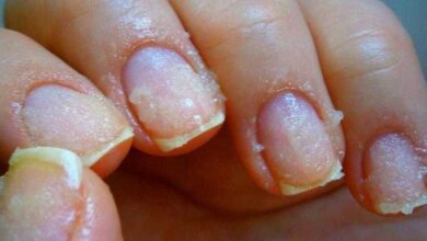 4 Maneiras naturais de fortalecer suas unhas e acelerar o crescimento! Veja: