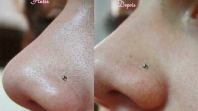 Como remover cravos do nariz usando água, sal e limão 4