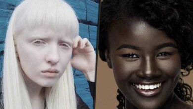 8 Pessoas com cores de pele excêntrica