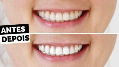 1749269467 5 Maneiras caseiras para voce branquear seus dentes 5 Maneiras caseiras para você branquear seus dentes