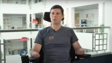 Homem teve os quatro membros amputados após inflar colchão de ar levar a condição grave