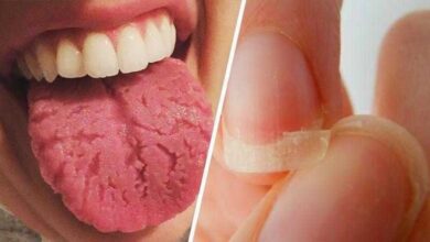 9 Sinais de que seu corpo está implorando por uma alimentação melhor