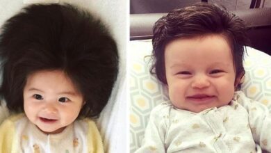 Pais compartilham fotos de bebês cabeludos viram sucesso na internet